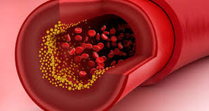 Benefits of Cholesterol